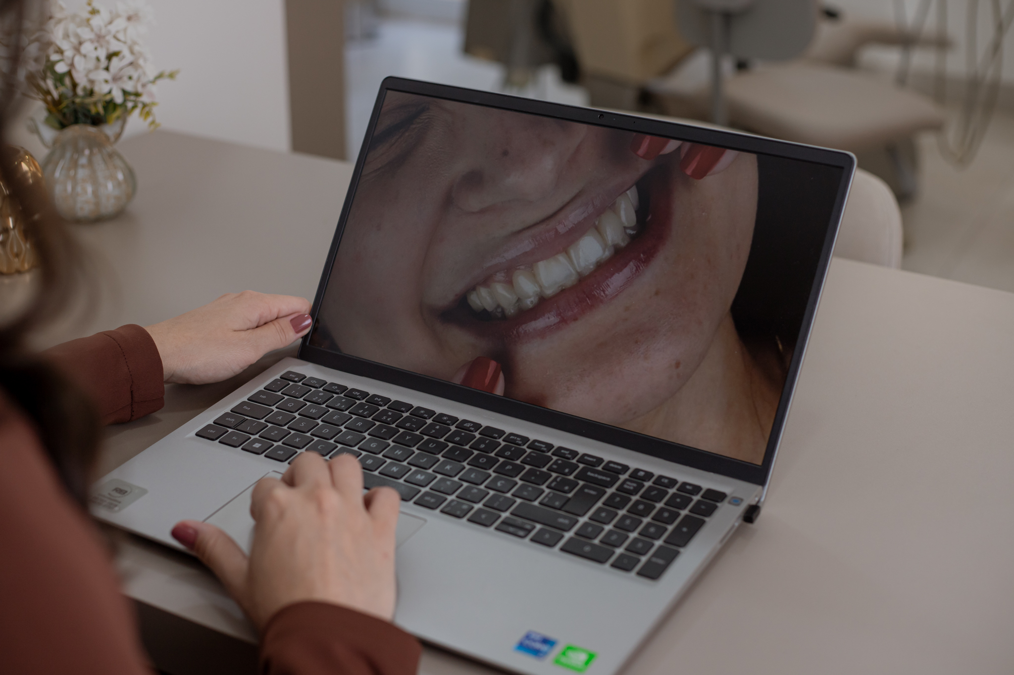 Procedimento periodontal para cuidado da saúde gengival